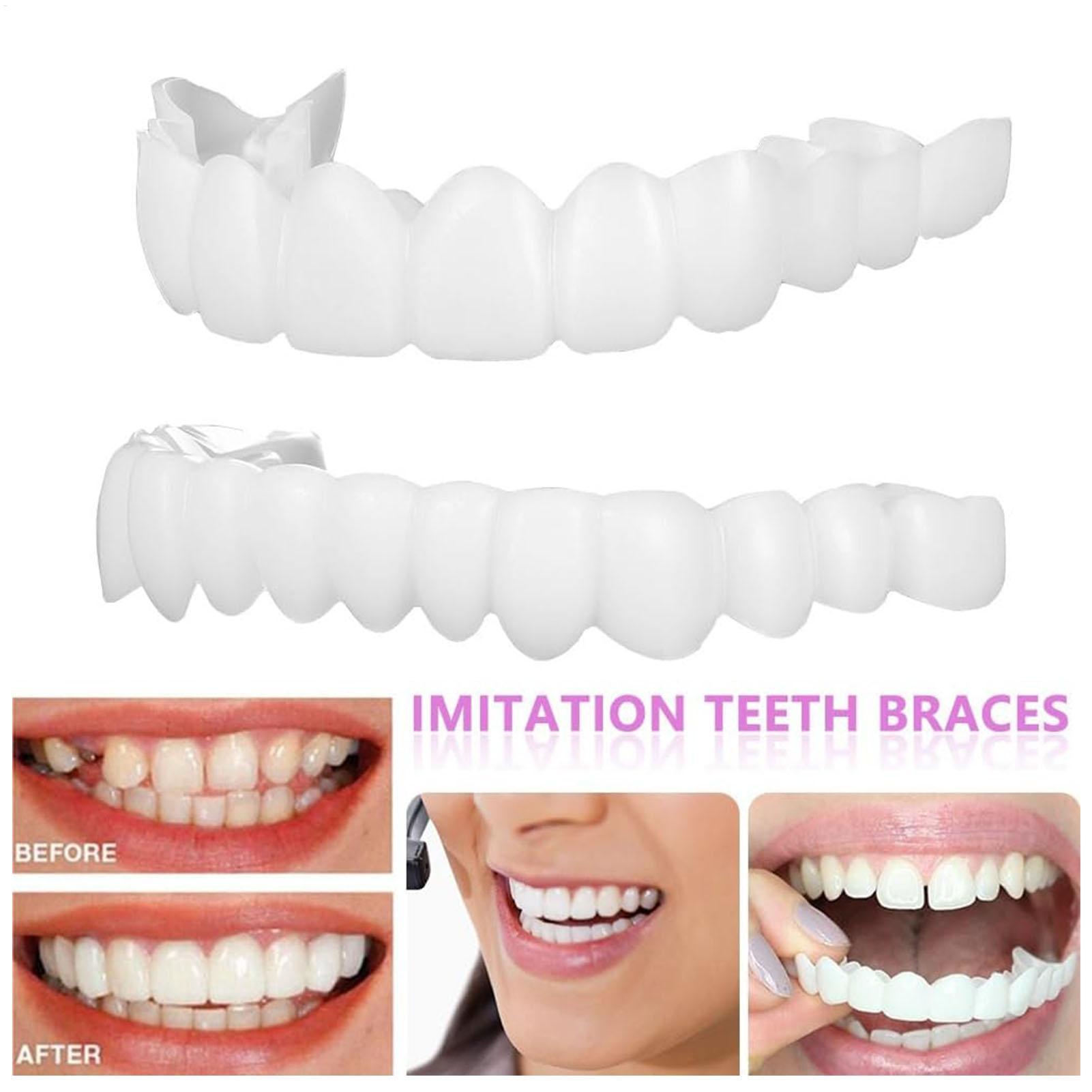 Teeth Whitening Veneers - Dental Upper Lower Fake Teeth Cover