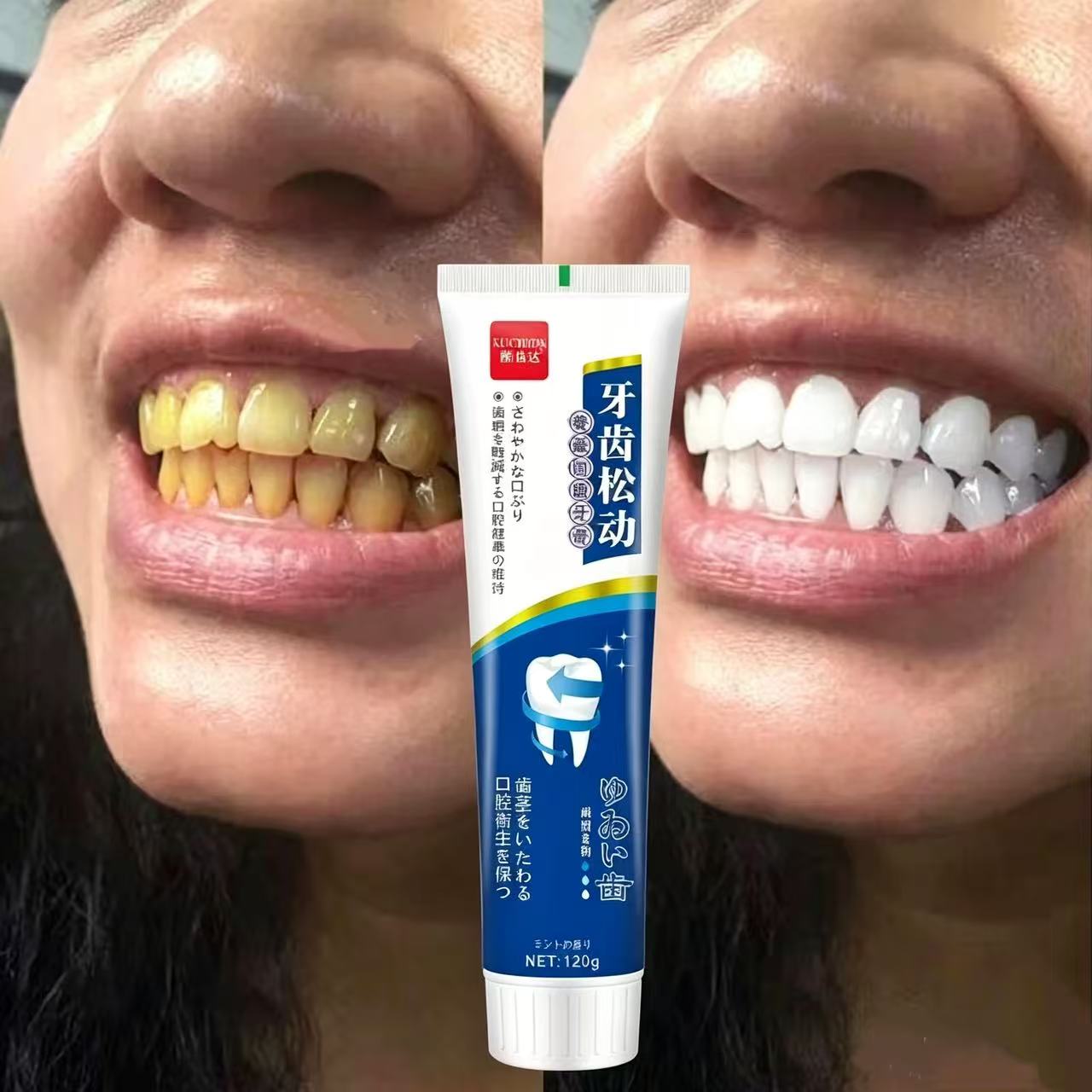 Teeth Whitening Japanese - Fix Loose Teeth Japanese Imported Toothpaste