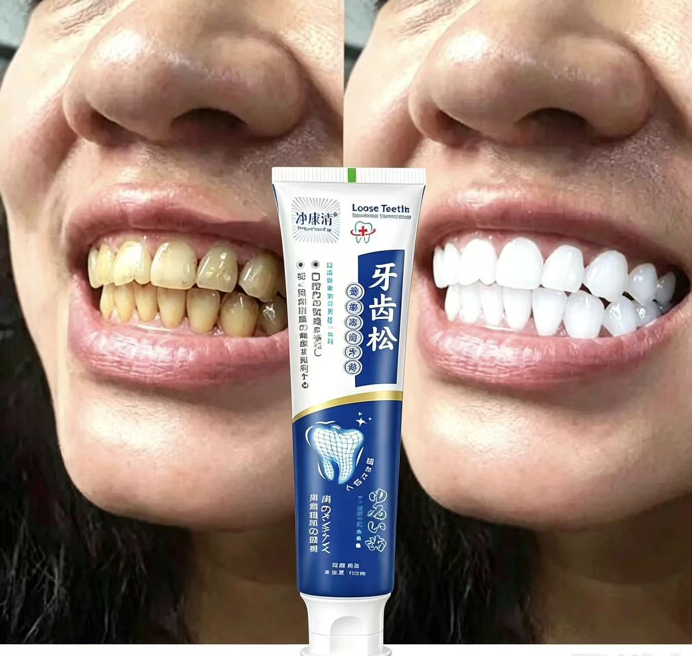 Teeth Whitening Japanese - Fix Loose Teeth Japanese Imported Toothpaste