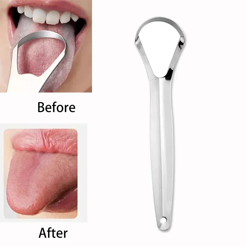 Tongue Scraper Metal - Halitosis Tongue Coating Tongue Scraper Stainless