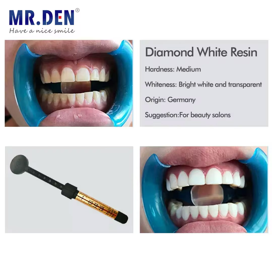 Teeth Whitening Veneers - Nano enamel veneer material teeth whitening