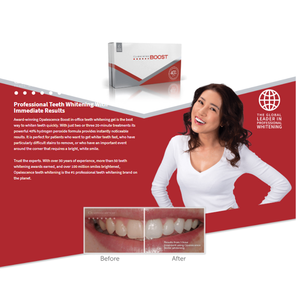 Opalescence Boost 40% PF Ameri - Teeth Whitening Gel Opalescence review and price