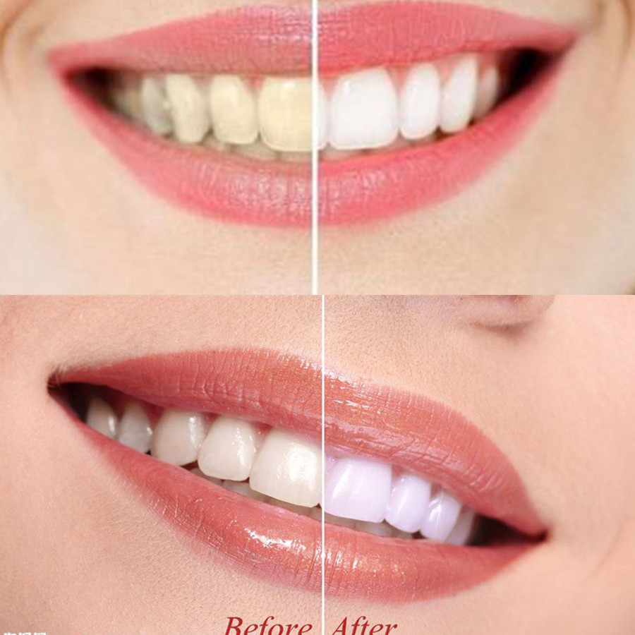 Bamboo Charcoal Teeth Tooth De - Teeth Whitening China review and price