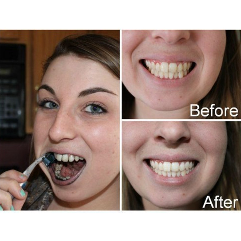 Bamboo Charcoal Teeth Tooth De - Teeth Whitening China review and price
