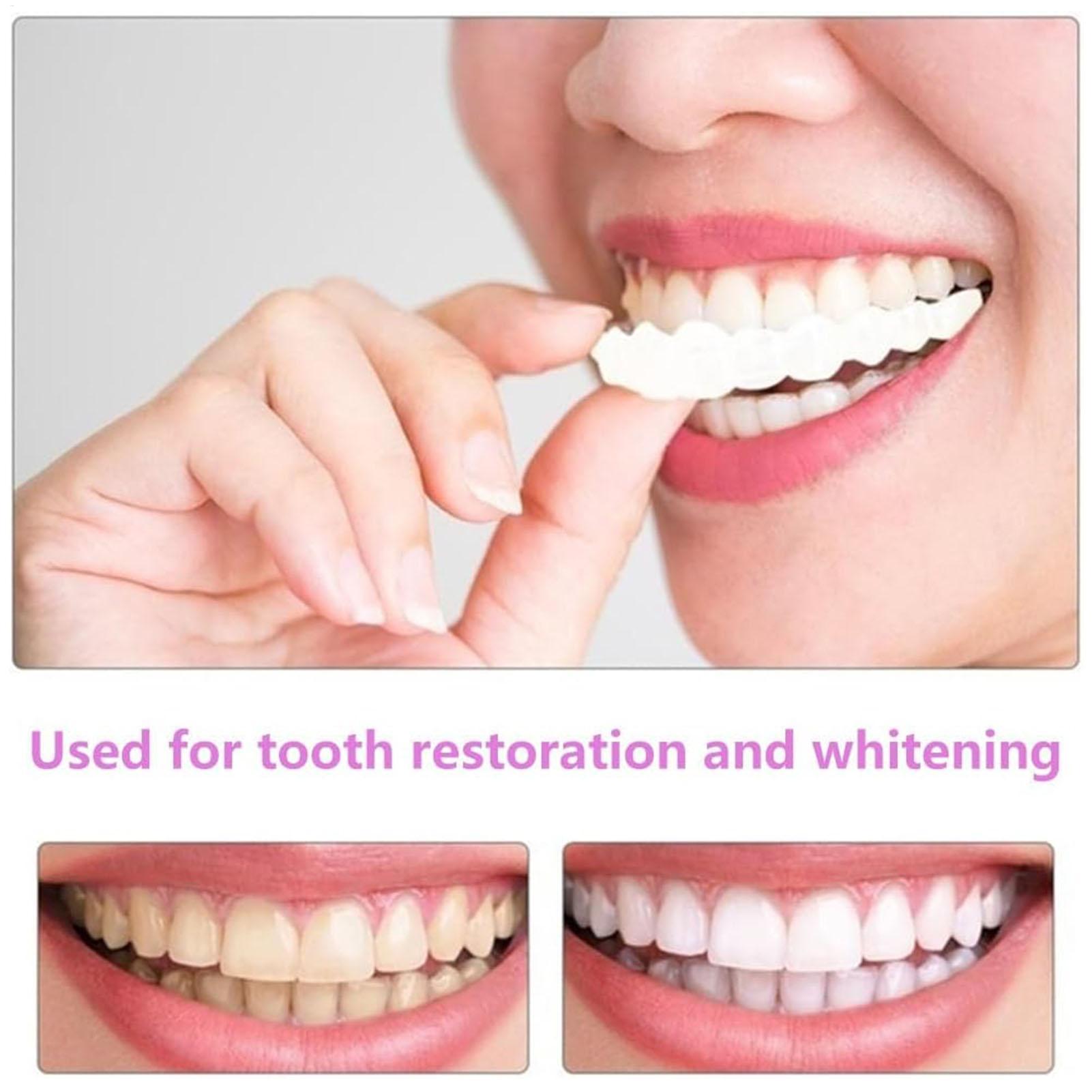Dental Upper Lower Fake Teeth  - Teeth Whitening Veneers review and price