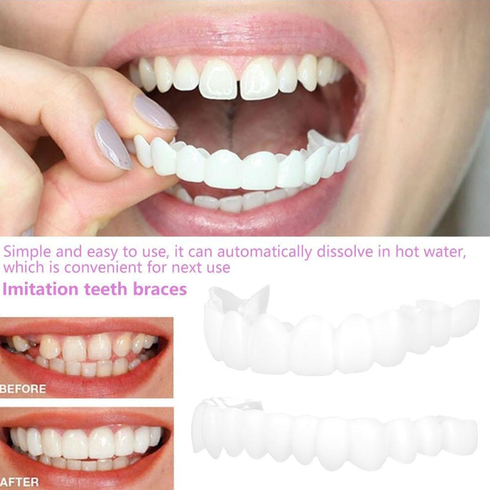 Dental Upper Lower Fake Teeth  - Teeth Whitening Veneers review and price