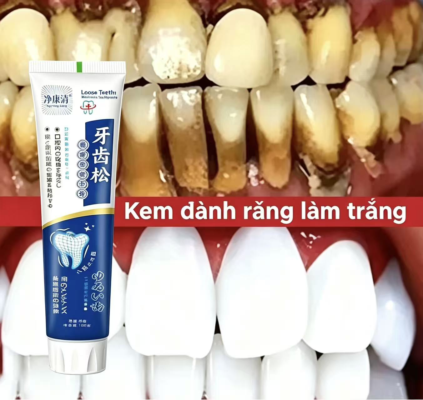 Fix Loose Teeth Japanese Impor - Teeth Whitening Japanese review and price