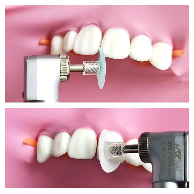 40Pcs Dental Polishing Disc Co - Teeth Whitening Home review and price