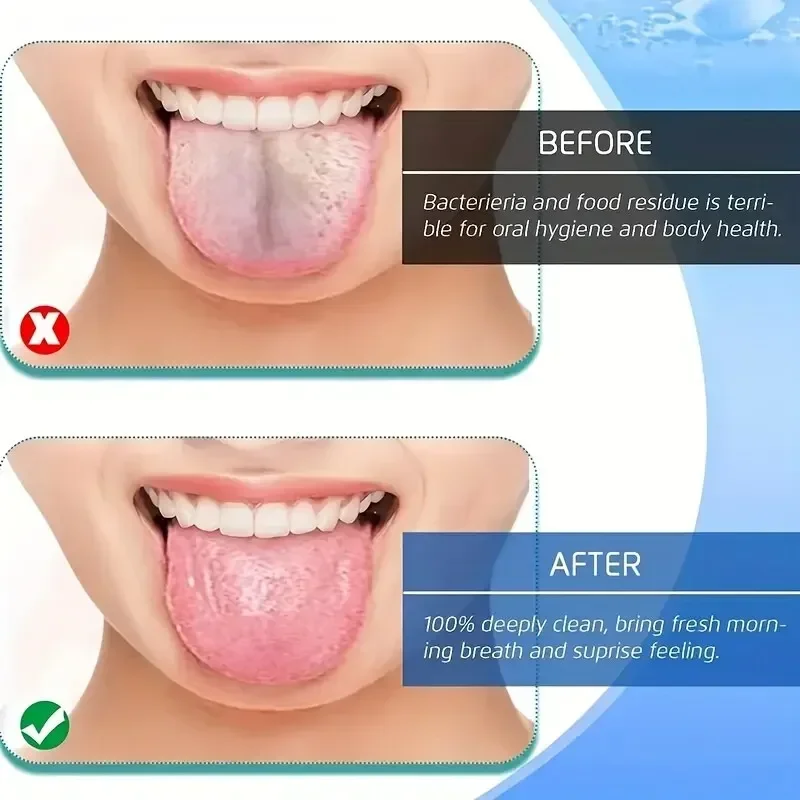 Breath Tongue Scraper Cleaning - Tongue Scraper Metal review and price