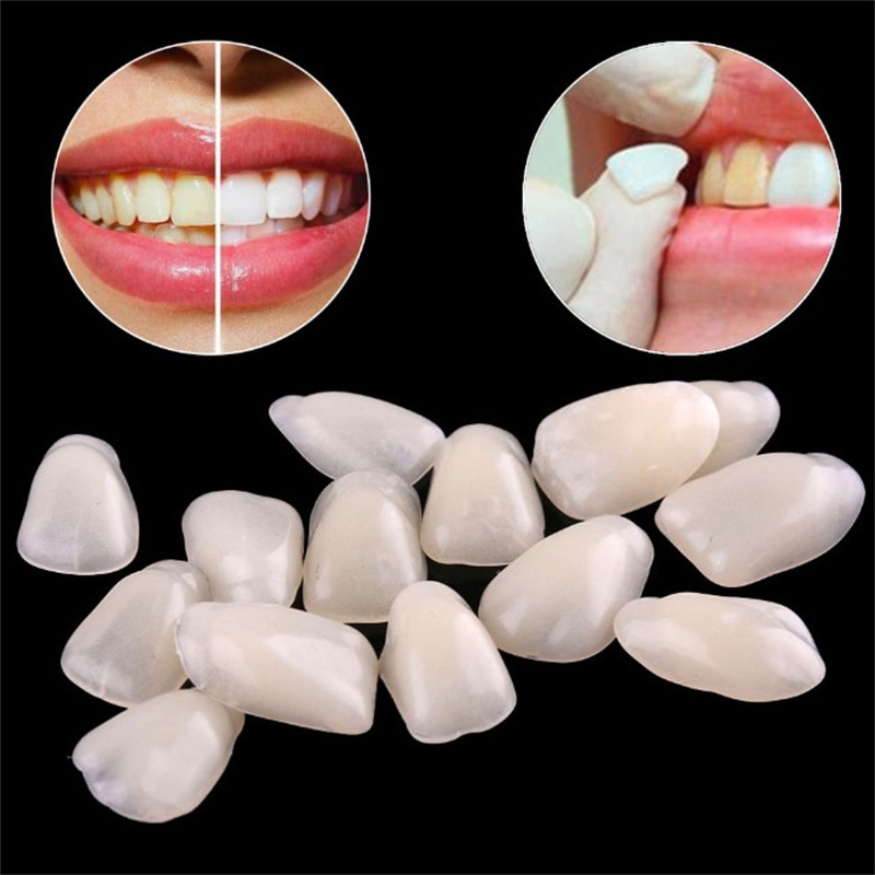 Temporary Dental Veneers - Ult - Teeth Whitening Veneers review and price