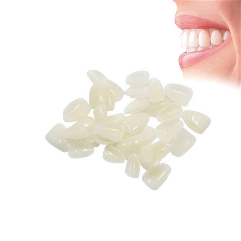 Temporary Dental Veneers - Ult - Teeth Whitening Veneers review and price