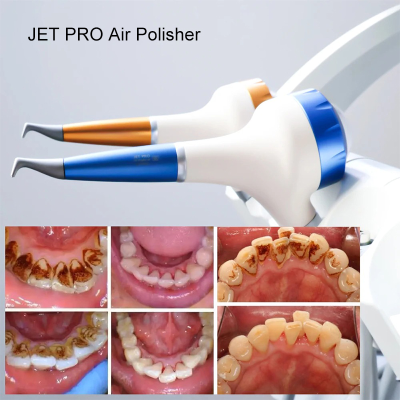 VV Dental  Air Polishing Proph - Teeth Whitening China review and price