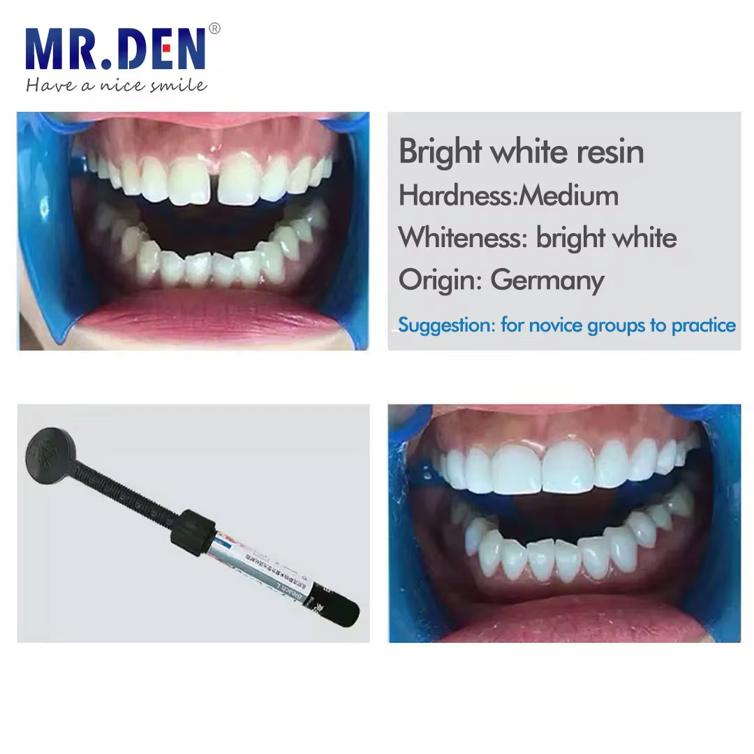 Nano enamel veneer material te - Teeth Whitening Veneers review and price