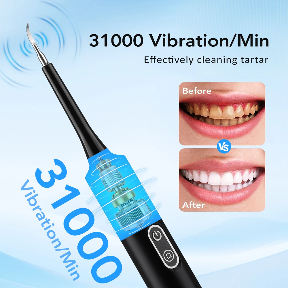 Electric Sonic Vibration Denta - Teeth Whitening Home review and price